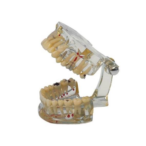 Modèle d'étude dentaire. Hager & Werken 355642