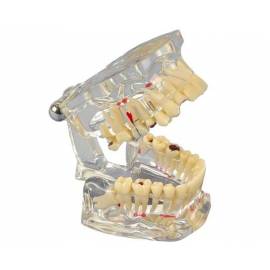 Modèle d'entrainement dentaire. H&W 355642